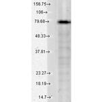 KCNQ1 K+ Channel Antibody in Western Blot (WB)