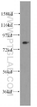 NCAPH Antibody in Western Blot (WB)