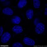 CENPJ Antibody in Immunocytochemistry (ICC/IF)