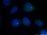 CENPJ Antibody in Immunocytochemistry (ICC/IF)