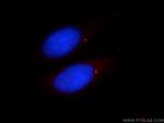 CENPJ Antibody in Immunocytochemistry (ICC/IF)