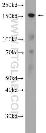 CENPJ Antibody in Western Blot (WB)