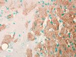 Nav1.7 Na+ Channel Antibody in Immunohistochemistry (Frozen) (IHC (F))