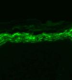 Nav1.7 Na+ Channel Antibody in Immunohistochemistry (Paraffin) (IHC (P))