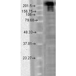 Nav1.7 Na+ Channel Antibody in Western Blot (WB)