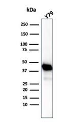 Creatine Phosphokinase-BB (CK-BB) Antibody in Western Blot (WB)