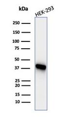 Creatine Phosphokinase-BB (CK-BB) Antibody in Western Blot (WB)