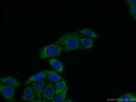 ECM1 Antibody in Immunocytochemistry (ICC/IF)