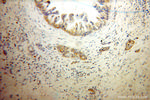 ECM1 Antibody in Immunohistochemistry (Paraffin) (IHC (P))