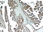 ECM1 Antibody in Immunohistochemistry (Paraffin) (IHC (P))