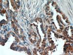 ECM1 Antibody in Immunohistochemistry (Paraffin) (IHC (P))