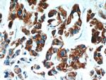 ECM1 Antibody in Immunohistochemistry (Paraffin) (IHC (P))