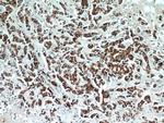 ECM1 Antibody in Immunohistochemistry (Paraffin) (IHC (P))