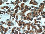 ECM1 Antibody in Immunohistochemistry (Paraffin) (IHC (P))