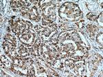 ECM1 Antibody in Immunohistochemistry (Paraffin) (IHC (P))