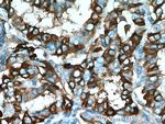 ECM1 Antibody in Immunohistochemistry (Paraffin) (IHC (P))