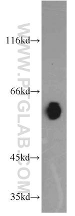 ECM1 Antibody in Western Blot (WB)