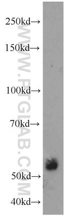 ECM1 Antibody in Western Blot (WB)