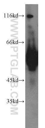 ECM1 Antibody in Western Blot (WB)