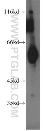 ECM1 Antibody in Western Blot (WB)