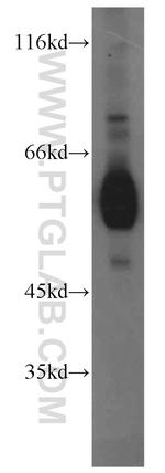 ECM1 Antibody in Western Blot (WB)