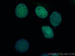 TGIF2 Antibody in Immunocytochemistry (ICC/IF)