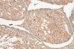 TGIF2 Antibody in Immunohistochemistry (Paraffin) (IHC (P))