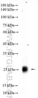 TGIF2 Antibody in Western Blot (WB)