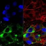 Nav1.8 Na+ Channel Antibody in Immunocytochemistry (ICC/IF)