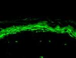 Nav1.8 Na+ Channel Antibody in Immunohistochemistry (Paraffin) (IHC (P))