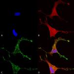 Cav beta Ca+2 Channel Antibody in Immunocytochemistry (ICC/IF)