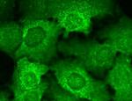 Cav beta Ca+2 Channel Antibody in Immunocytochemistry (ICC/IF)