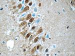 UCHL5 Antibody in Immunohistochemistry (Paraffin) (IHC (P))