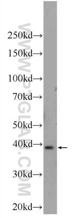 UCHL5 Antibody in Western Blot (WB)