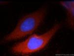 SRP14 Antibody in Immunocytochemistry (ICC/IF)