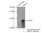 SRP14 Antibody in Immunoprecipitation (IP)