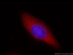 ASCC2 Antibody in Immunocytochemistry (ICC/IF)