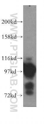 ASCC2 Antibody in Western Blot (WB)