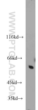 CaMKII beta Antibody in Western Blot (WB)