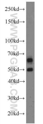 CaMKII beta Antibody in Western Blot (WB)