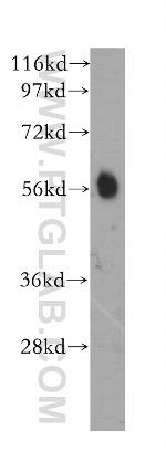 CaMKII beta Antibody in Western Blot (WB)