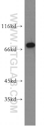 MAGED1 Antibody in Western Blot (WB)