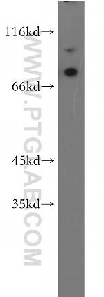 MAGED1 Antibody in Western Blot (WB)