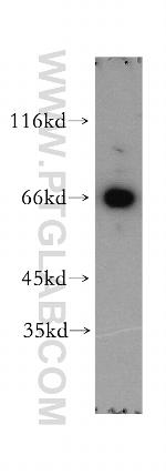 MAGED1 Antibody in Western Blot (WB)