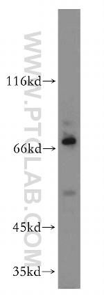 PLAGL2 Antibody in Western Blot (WB)