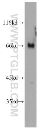 MOXD1 Antibody in Western Blot (WB)