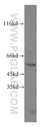 MOXD1 Antibody in Western Blot (WB)