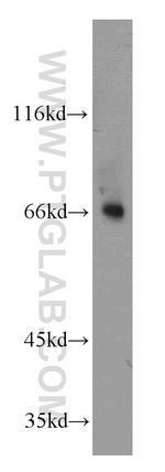 MOXD1 Antibody in Western Blot (WB)