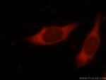 NMT1 Antibody in Immunocytochemistry (ICC/IF)