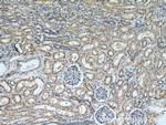 NMT1 Antibody in Immunohistochemistry (Paraffin) (IHC (P))